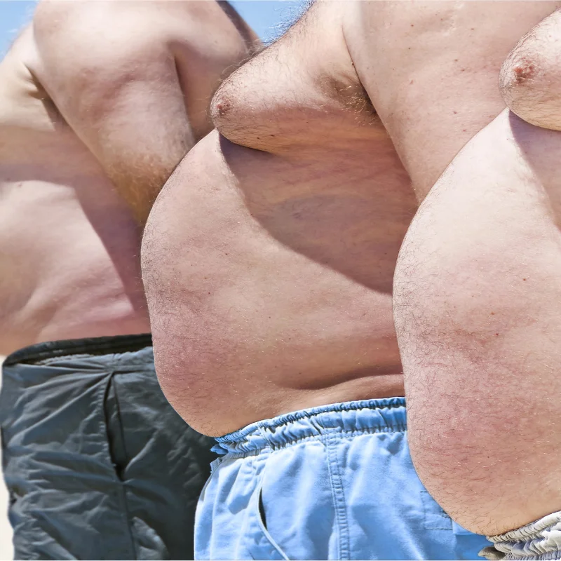 Stupně obezity: BMI tabulka a zdravotní rizika